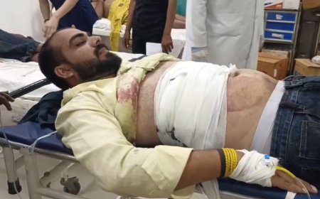 प्रेम प्रसंग में फायरिंग तीन घायल उपचार जारी लड़की के मामा पक्ष ने रात को विवाद कर चलाई गोली