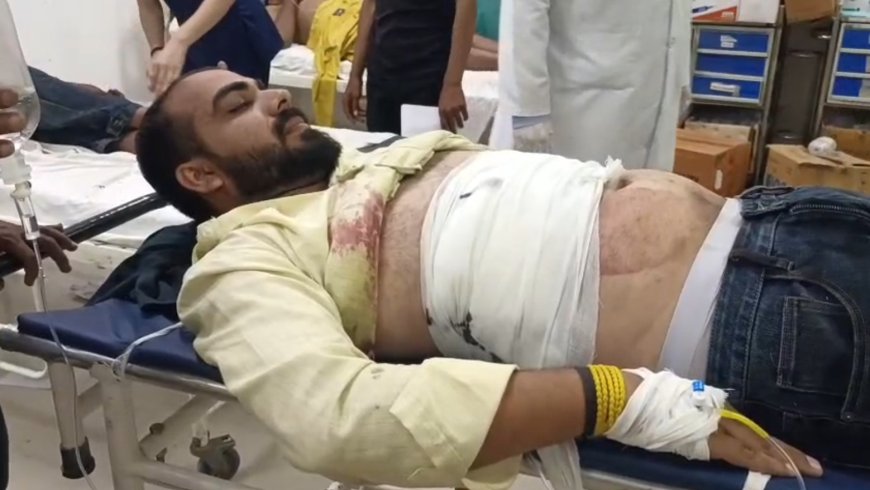 प्रेम प्रसंग में फायरिंग तीन घायल उपचार जारी लड़की के मामा पक्ष ने रात को विवाद कर चलाई गोली