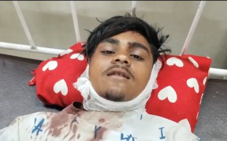 देवी धाम मैहर में फल विक्रेता पर जानलेवा हमला, सिर पर लोहे के बांट से वार; गंभीर हालत में सतना रेफर
