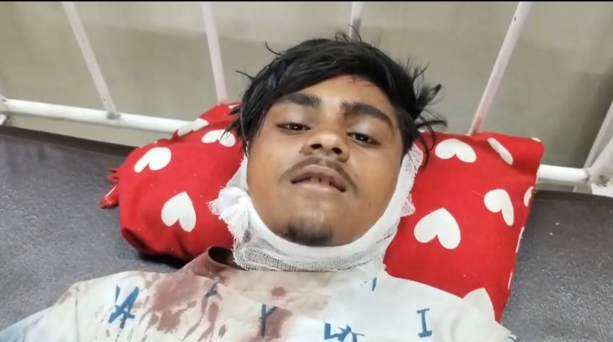 देवी धाम मैहर में फल विक्रेता पर जानलेवा हमला, सिर पर लोहे के बांट से वार; गंभीर हालत में सतना रेफर