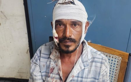 टीवी का चैनल बदलना पड़ा भारी! भोपाल में पत्नी ने पति पर हंसिए से किया हमला, सिर और गाल पर आई चोट