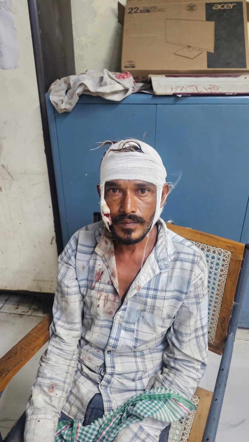 टीवी का चैनल बदलना पड़ा भारी! भोपाल में पत्नी ने पति पर हंसिए से किया हमला, सिर और गाल पर आई चोट