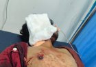 भोपाल में वाइन शॉप पर युवक पर जानलेवा हमला, हालत नाजुक