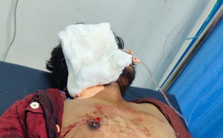 भोपाल में वाइन शॉप पर युवक पर जानलेवा हमला, हालत नाजुक