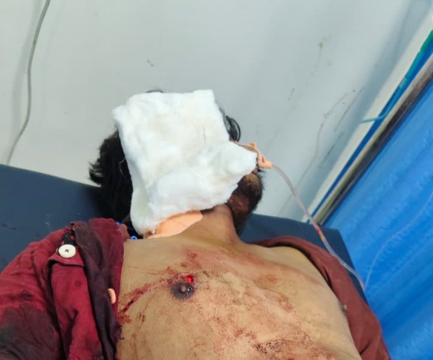 भोपाल में वाइन शॉप पर युवक पर जानलेवा हमला, हालत नाजुक