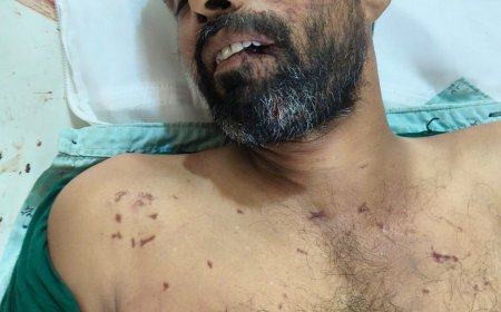 परवलिया सड़क इलाके में दर्दनाक हादसा, होंडा शोरूम की जर्जर दीवार ढहने से मजूदर की मौत