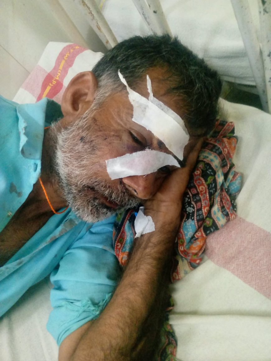 जमीन विवाद में कुल्हाड़ी से जानलेवा हमला, पुलिस पर मामूली धाराओं में केस दर्ज करने का आरोप